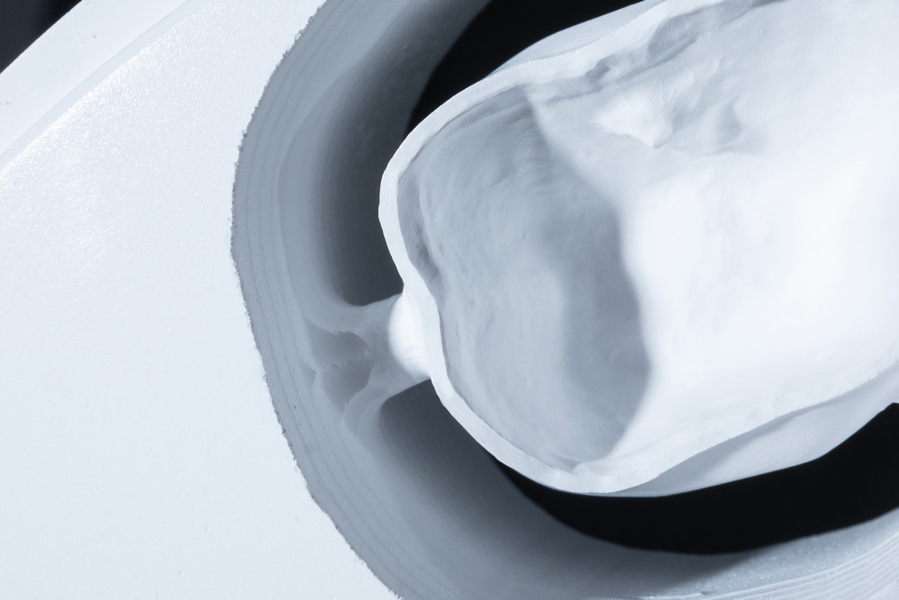 Dettaglio corona in zirconia fresata