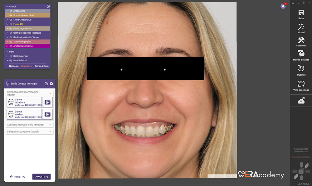 Intelligenza artificiale New Smile Digital