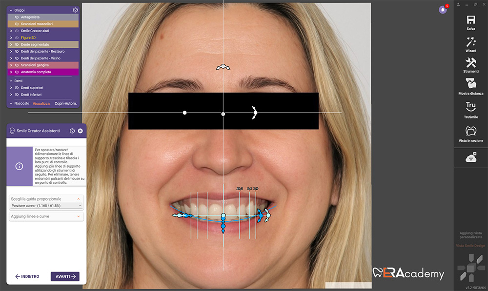 Intelligenza artificiale New Smile Digital