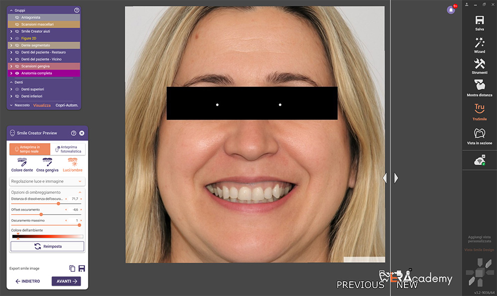 Intelligenza artificiale New Smile Digital