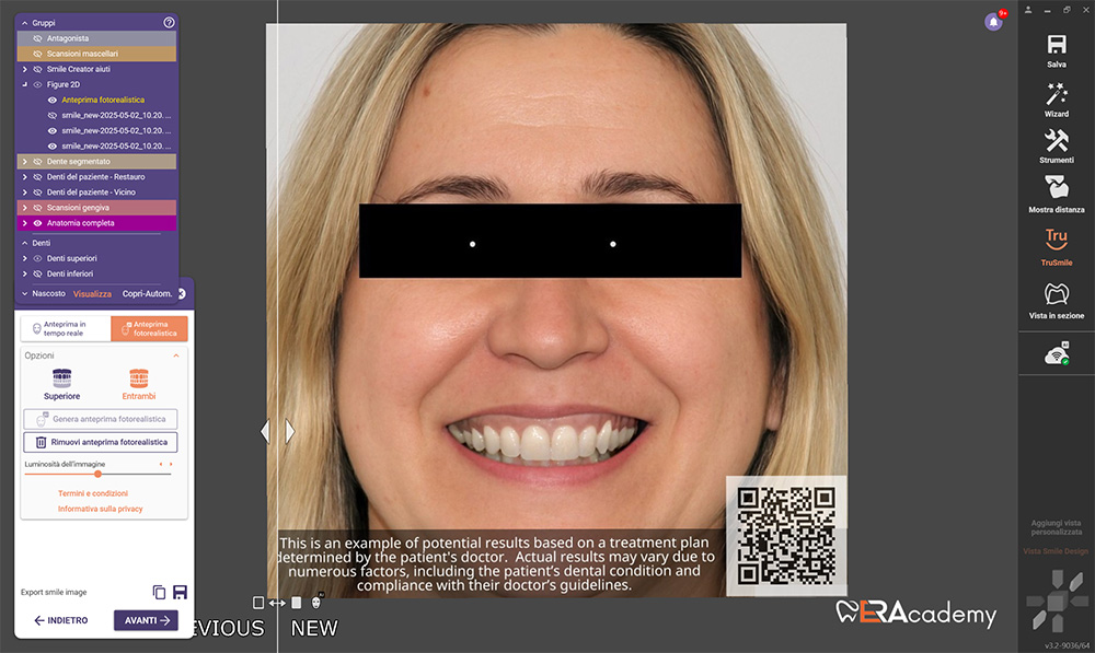 Intelligenza artificiale New Smile Digital