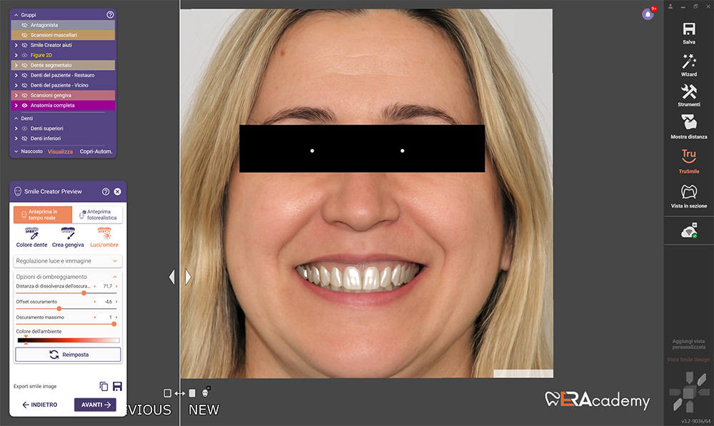 Intelligenza artificiale New Smile Digital