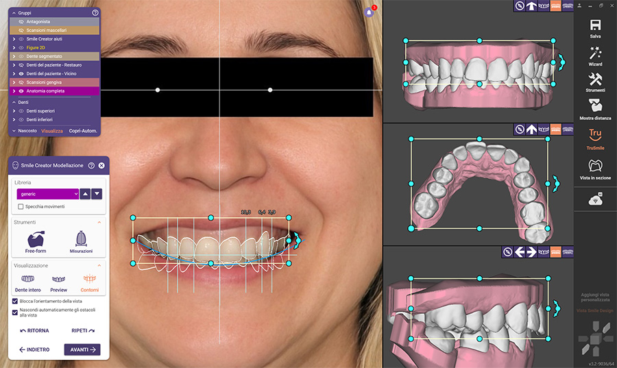Intelligenza artificiale New Smile Digital